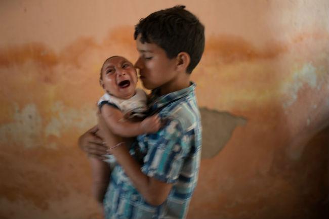 A pesar de que Brasil ha recibido reportes de 6,158 casos de microcefalia en todo el país desde que apareció la epidemia de zika, hasta ahora sólo han sido confirmados 745 casos.